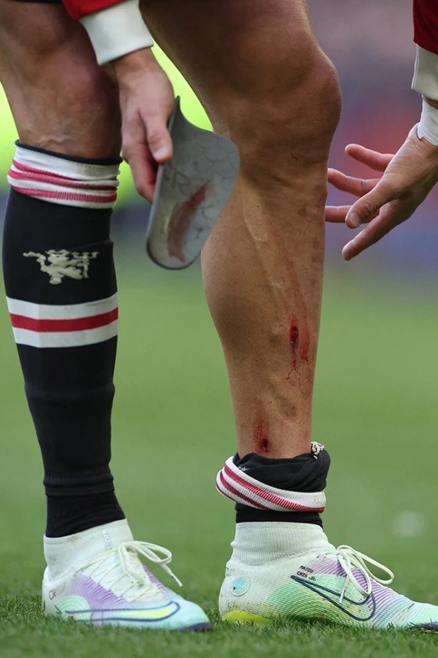 c罗头破血流对手被罚下场,c罗输球后跪地痛哭