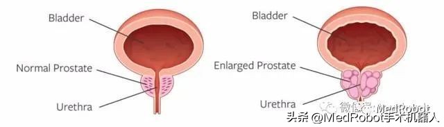 机器人前三季度业绩6200,机器人产业年收入突破1000亿