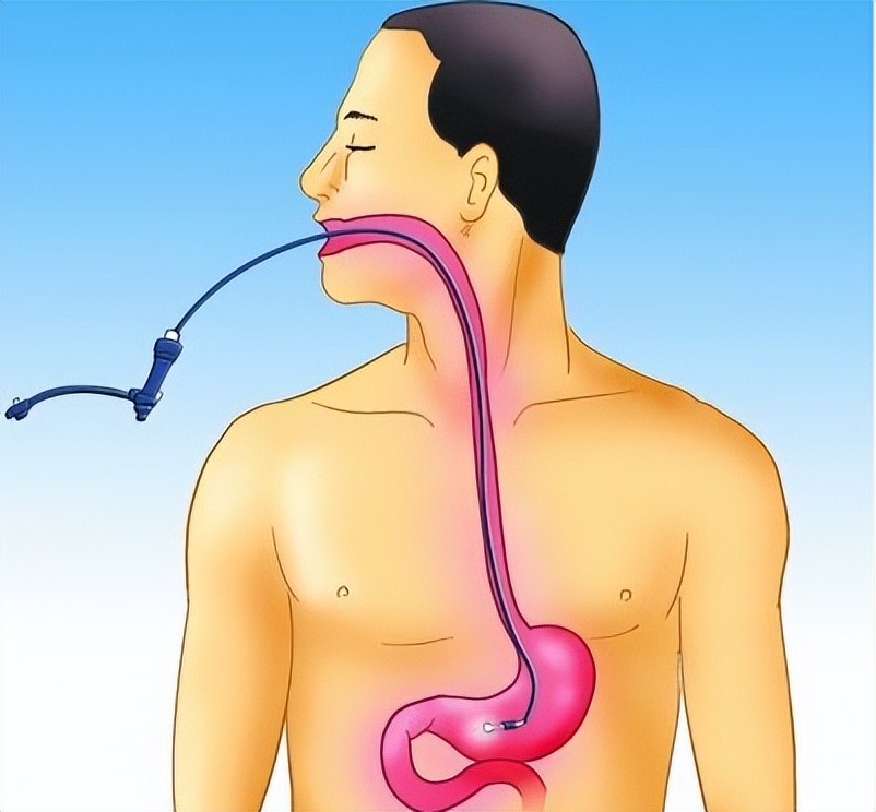 内镜中心胃镜操作全过程,带你了解内镜检查之胃镜