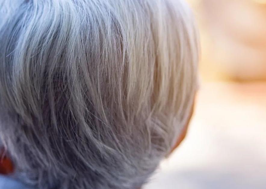 隐私部位的毛发变白，意味着体内有疾病吗？能不能刮掉？