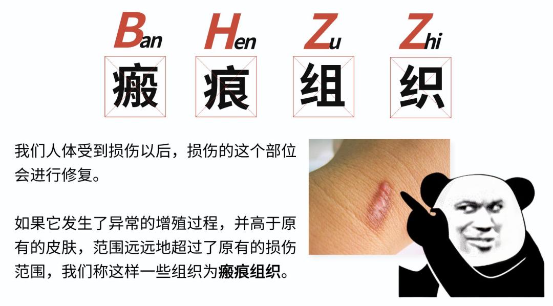 肚脐眼凸出来是脐带没剪好吗,为什么肚脐眼上面有一条凹线