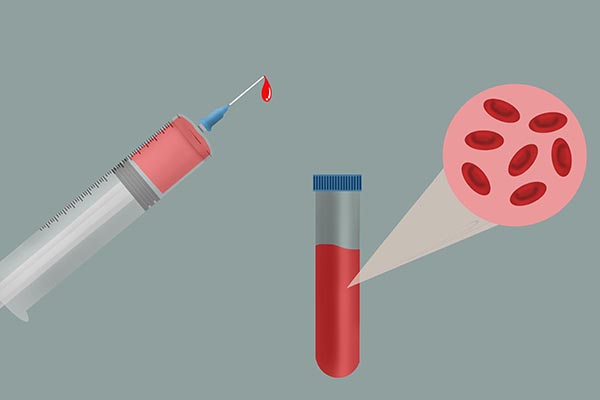 为什么医生抽血抽那么多,医院为什么要重复抽血