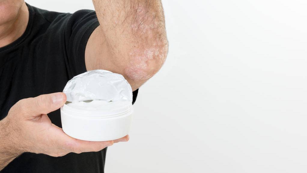 身上好多小片白癜风是什么白癜风,身上长了五处白癜风白斑严重吗