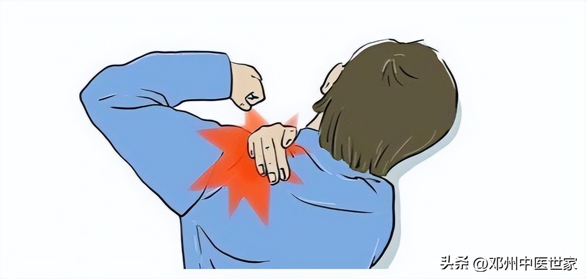 肩周炎（五十肩、肩凝）、医案