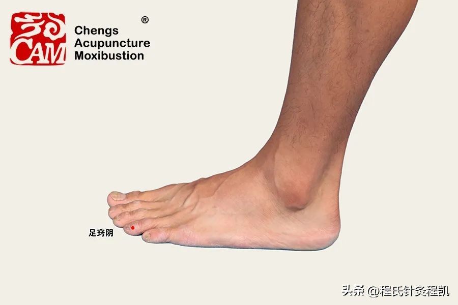 程凯养生说湿疹如何治疗,程凯养生说湿疹全部视频