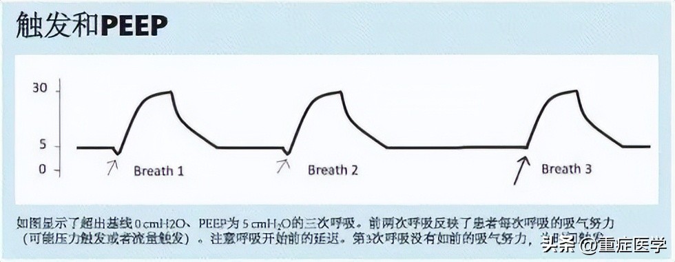 成人机械通气,成人机械基础课程设计