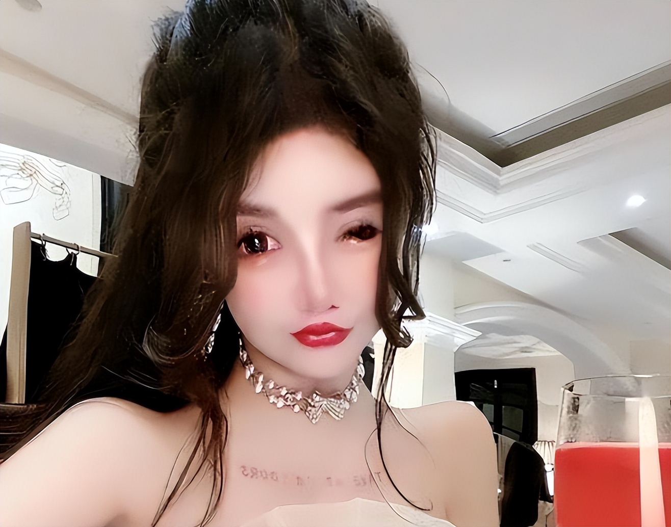 整容狂人整容100多次,整容狂魔手术200次