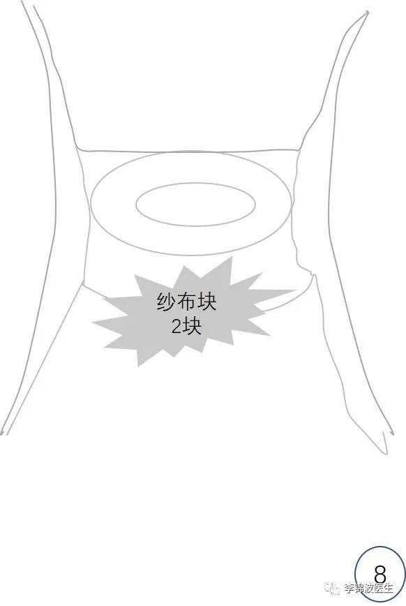 宫颈环扎术的详细步骤,宫颈环扎线拆除多少钱