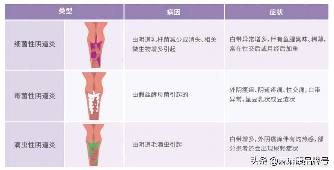 女性为什么得了宫颈炎,阴道炎盆腔炎宫颈炎有什么症状