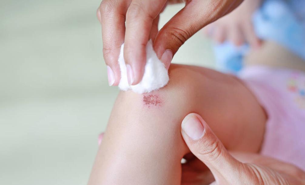 小伤口特别疼要怎么办,小伤口别大意