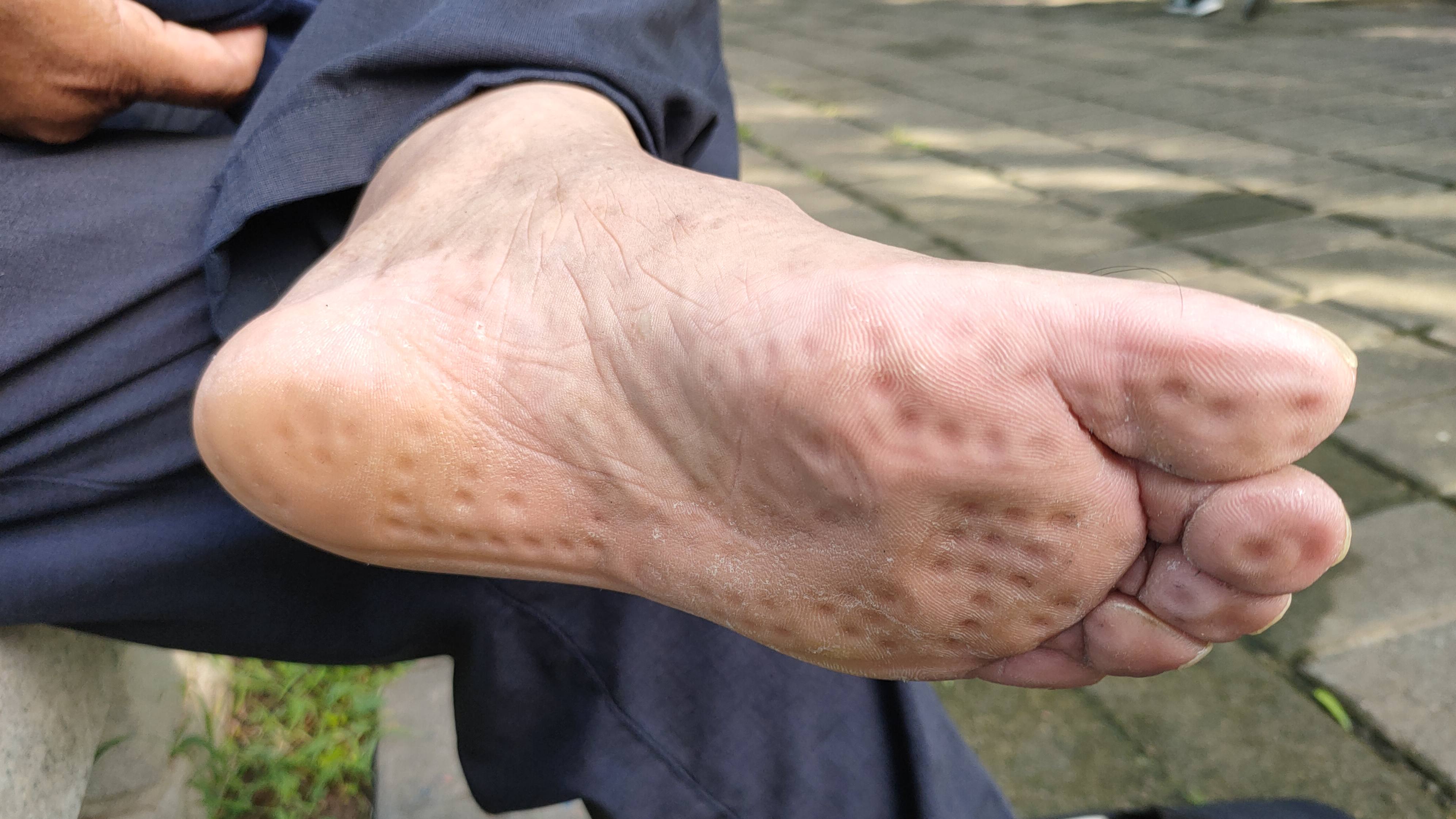 按摩鞋是不是智商税,足疗鞋是交智商税吗