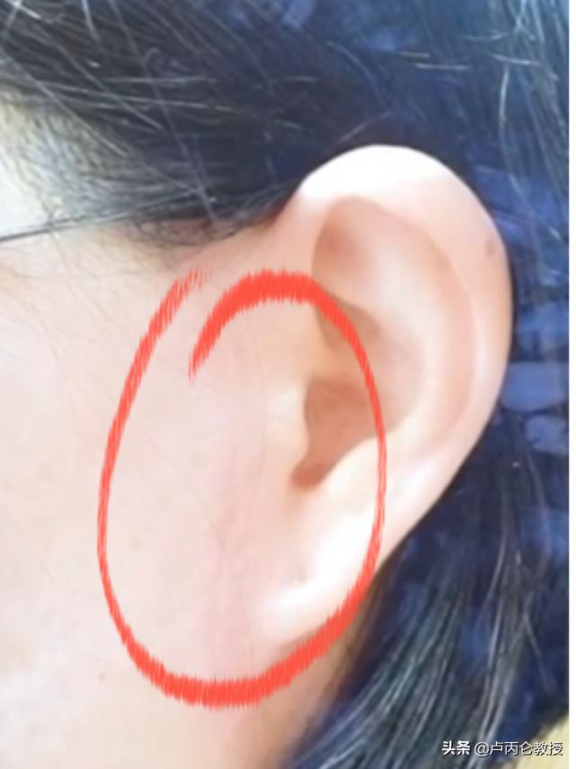 拉皮除皱手术有哪些,拉皮除皱手术的危害