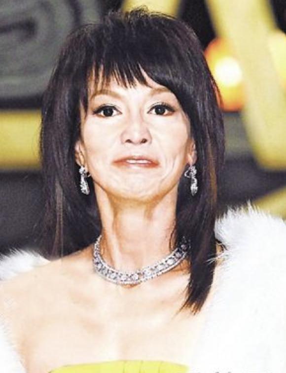 老演员整容脸变形,老年人整容前后照片