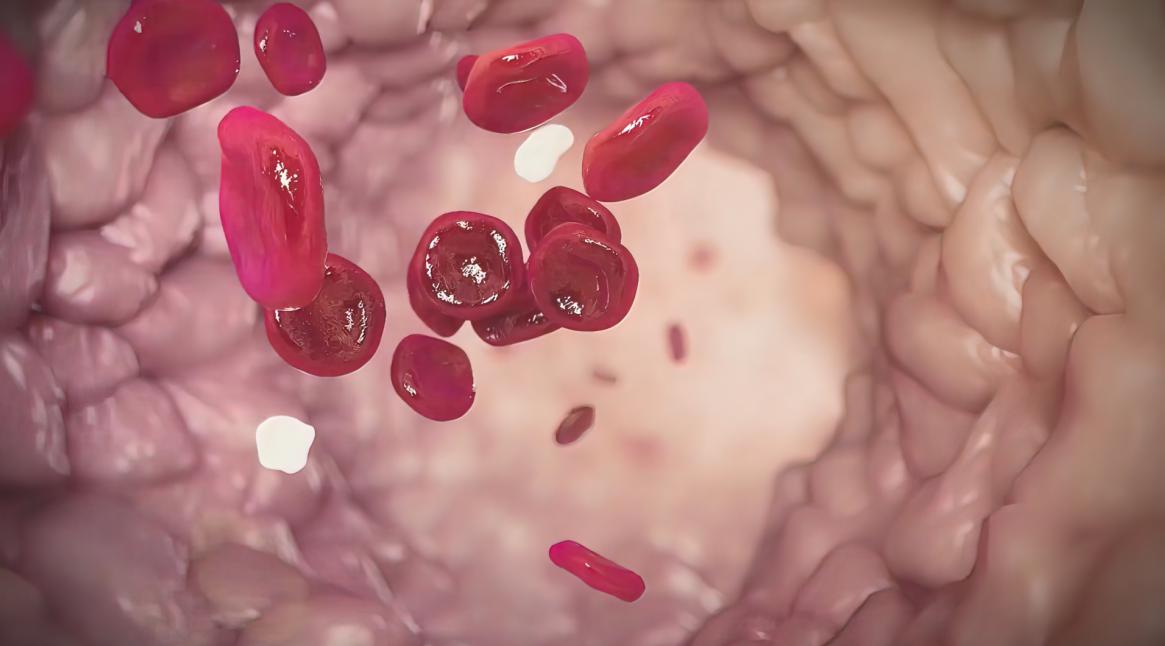 射血分数降低心力衰竭最常见原因,射血分数降低心力衰竭3级