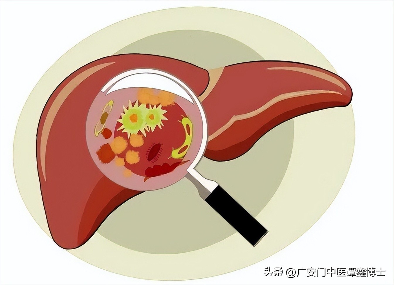 肝癌出现牙龈出血是前期还是后期,肝癌早期会引起便血吗