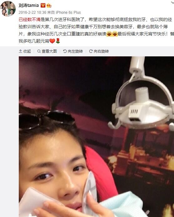 明星做烤瓷牙变凸嘴,明星烤瓷牙凸嘴