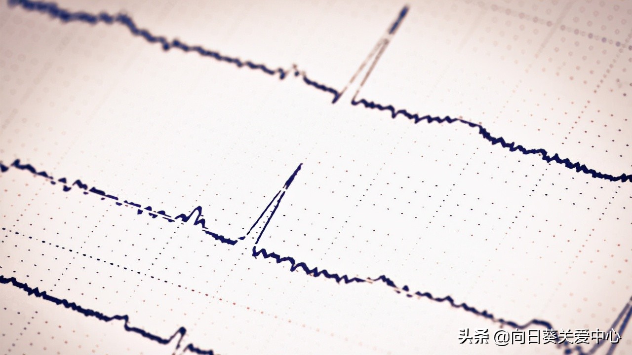 婴儿眼睑痉挛最佳治疗方法,婴儿痉挛症预后如何