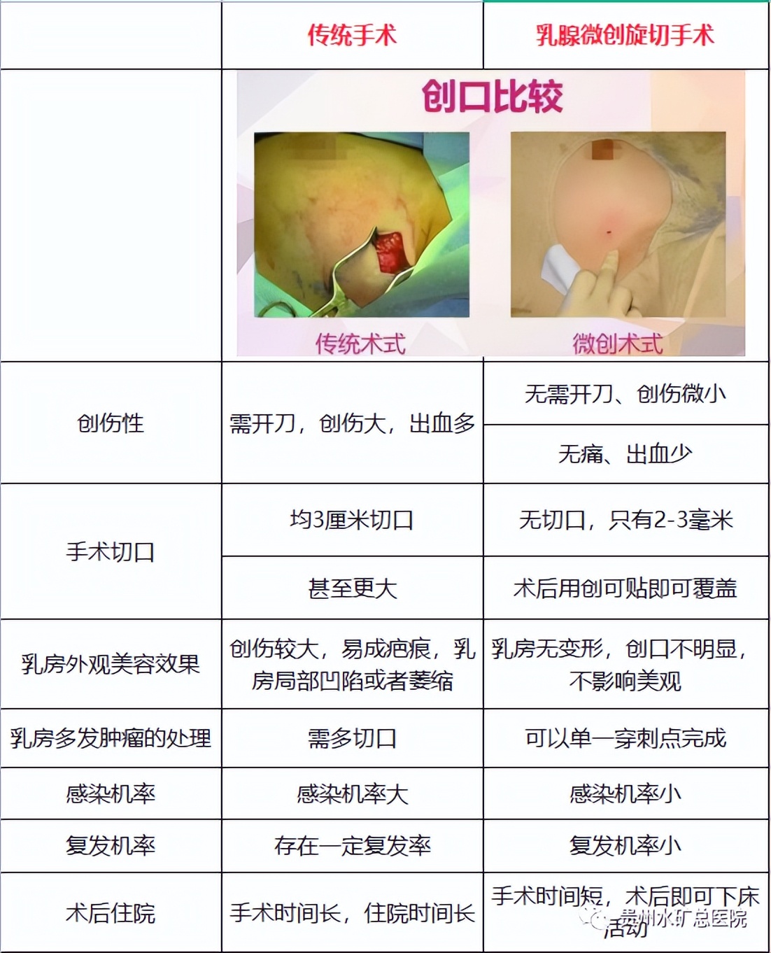 水矿总医院分院,乳房活检与旋切系统属于什么设备