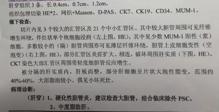 黄疸胆红素反复升高怎么回事,黄疸会导致谷草转氨酶升高吗