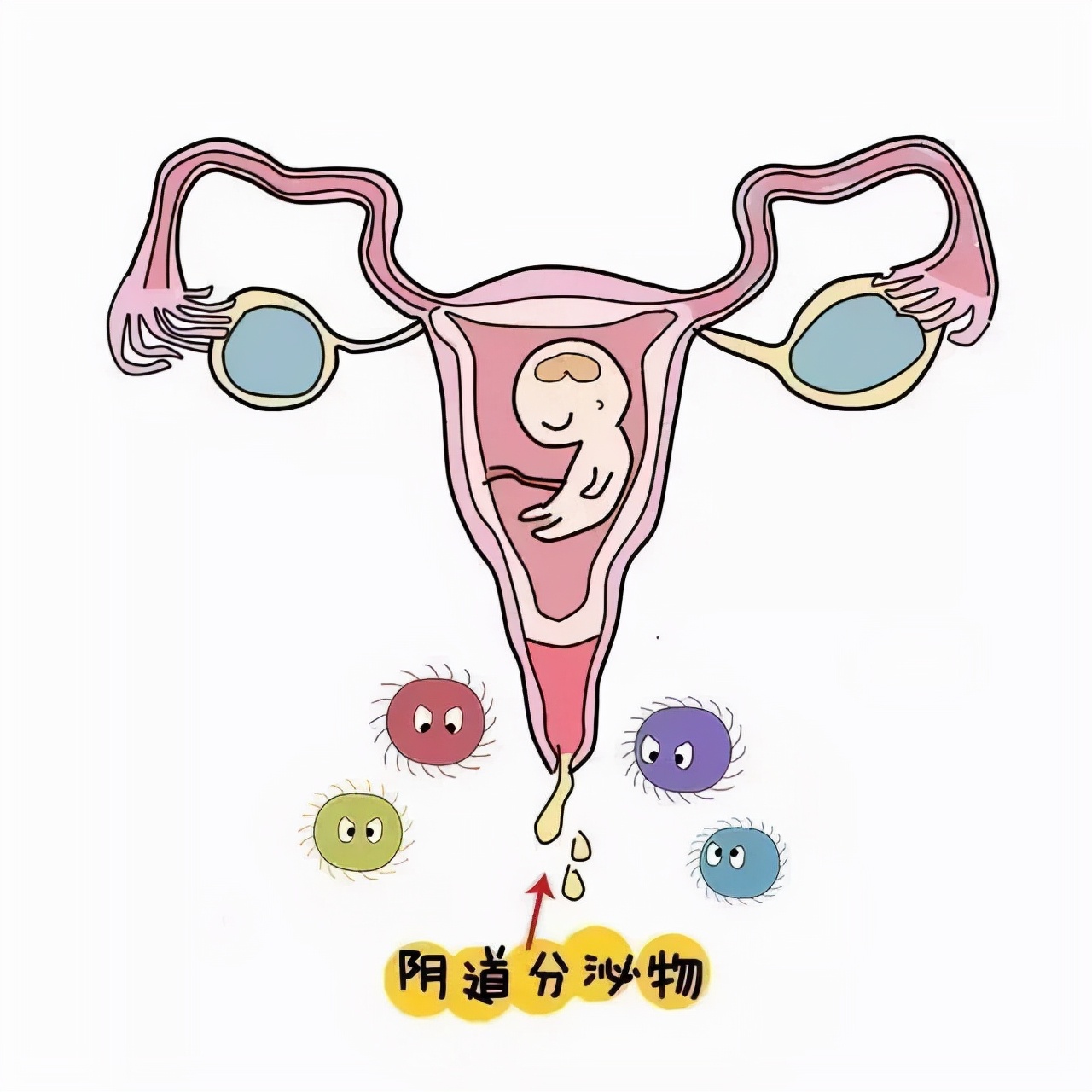 怀孕了一直出血是已经流产了吗,怀孕后大出血流产了是什么原因