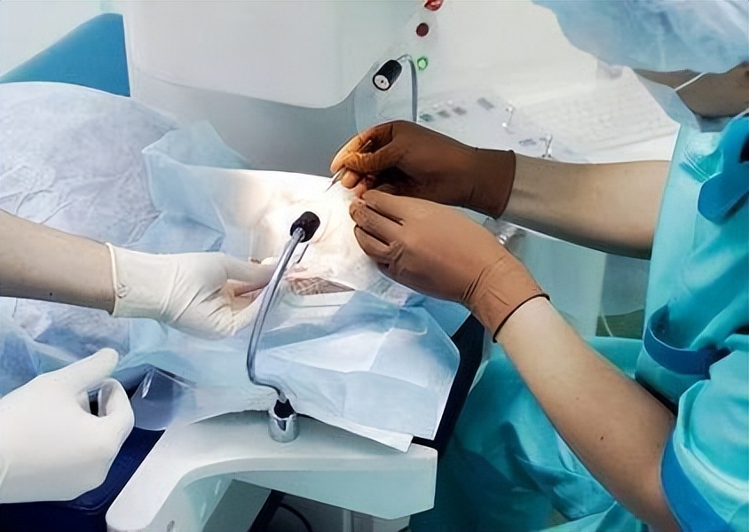 激光手术治近视眼可怕吗,激光手术治疗近视眼靠谱吗