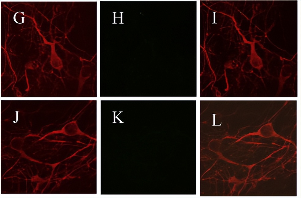 tau鎶椾綋,tau鎶椾綋涓村簥璇曢獙