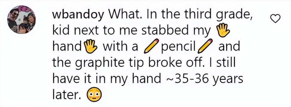 美国女子被橡皮子弹击中,女子手术取出戳20年铅笔芯