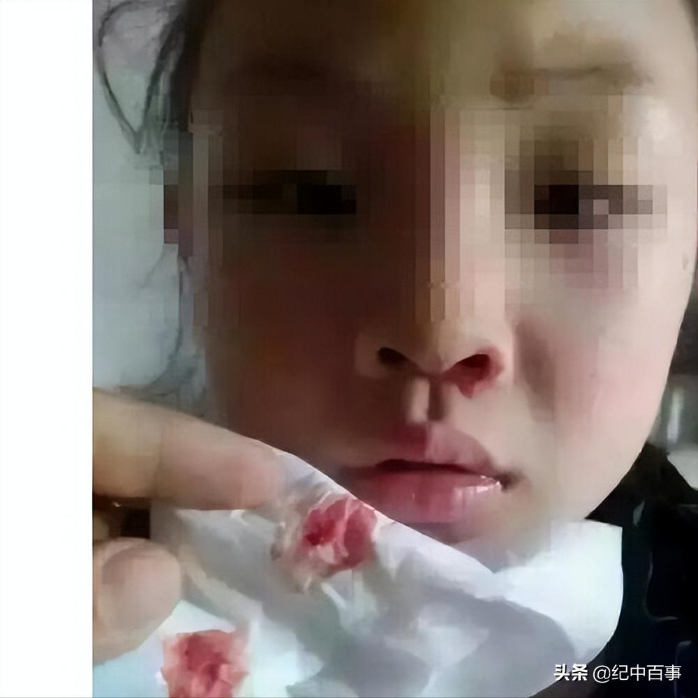 小女孩得了白血病因为穷放弃治疗,13岁女孩患白血病求妈妈放弃治疗