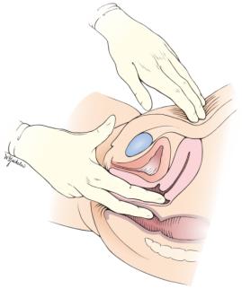 体检妇科不过怎么办,体检中哪些妇科病不用治