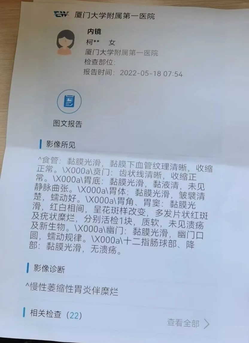 胃窦重度萎缩重度肠化多久会癌变,萎缩性胃炎重度肠化癌变几率
