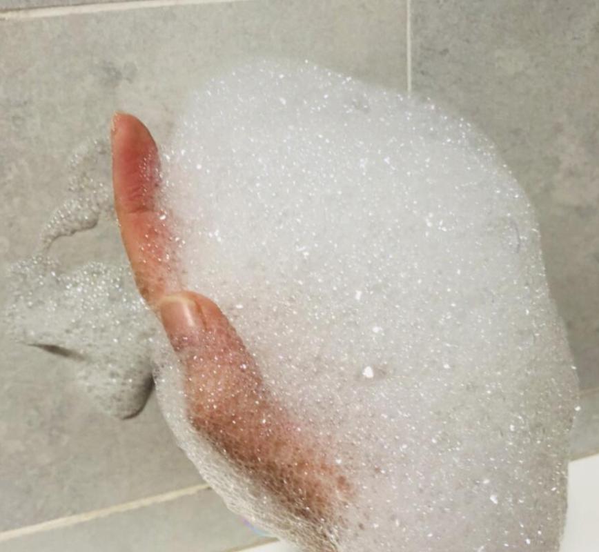 蜱虫比虱子厉害吗,怎么判断蜱虫和虱子