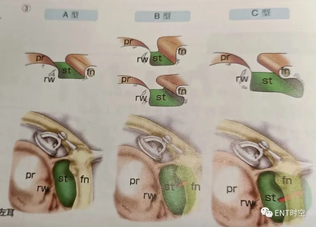 耳部解剖结构和生理功能,耳部解剖笔记