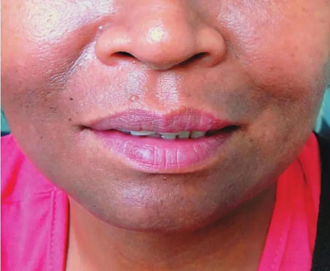 用很多护肤品脸还得很干,感觉化妆品越用脸反而有点黑