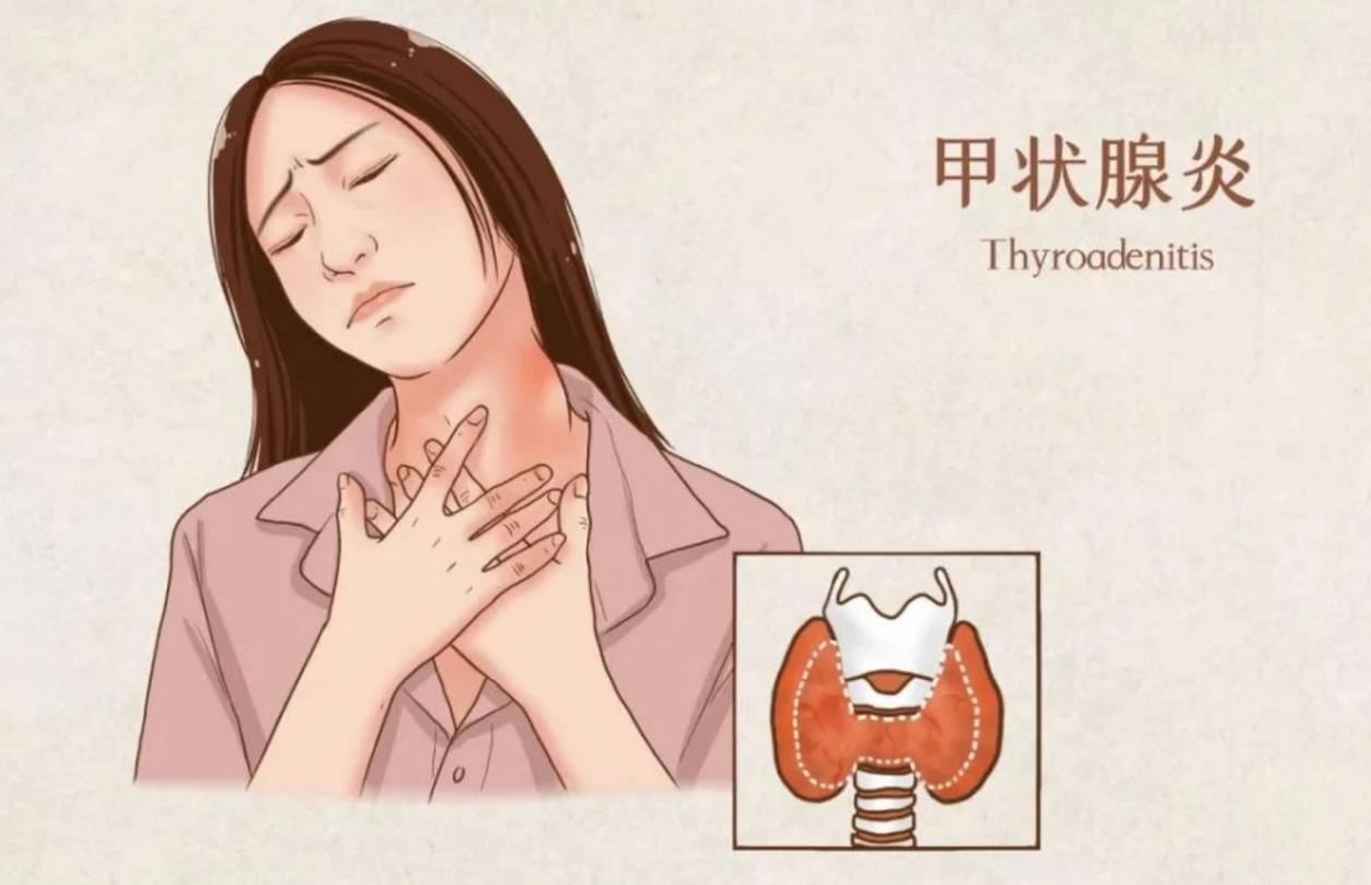 脖子突然特别难受怎么处理,脖子疼痛需警惕亚急性甲状腺炎