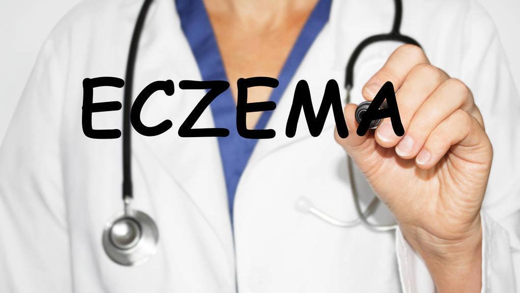 湿疹特别痒用什么药最有效,湿疹很痒用什么药膏最有效