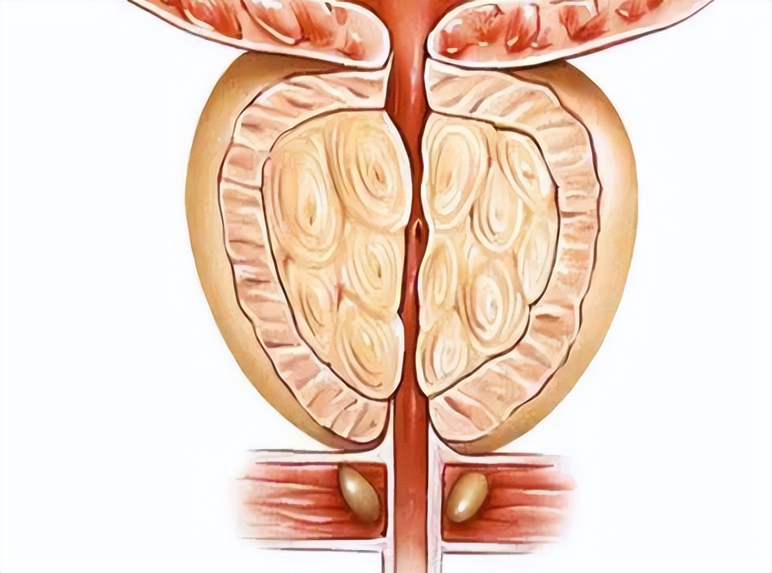 肛门瘙痒潮湿是什么原因怎么治疗,肛门周围潮湿又痒怎么治疗