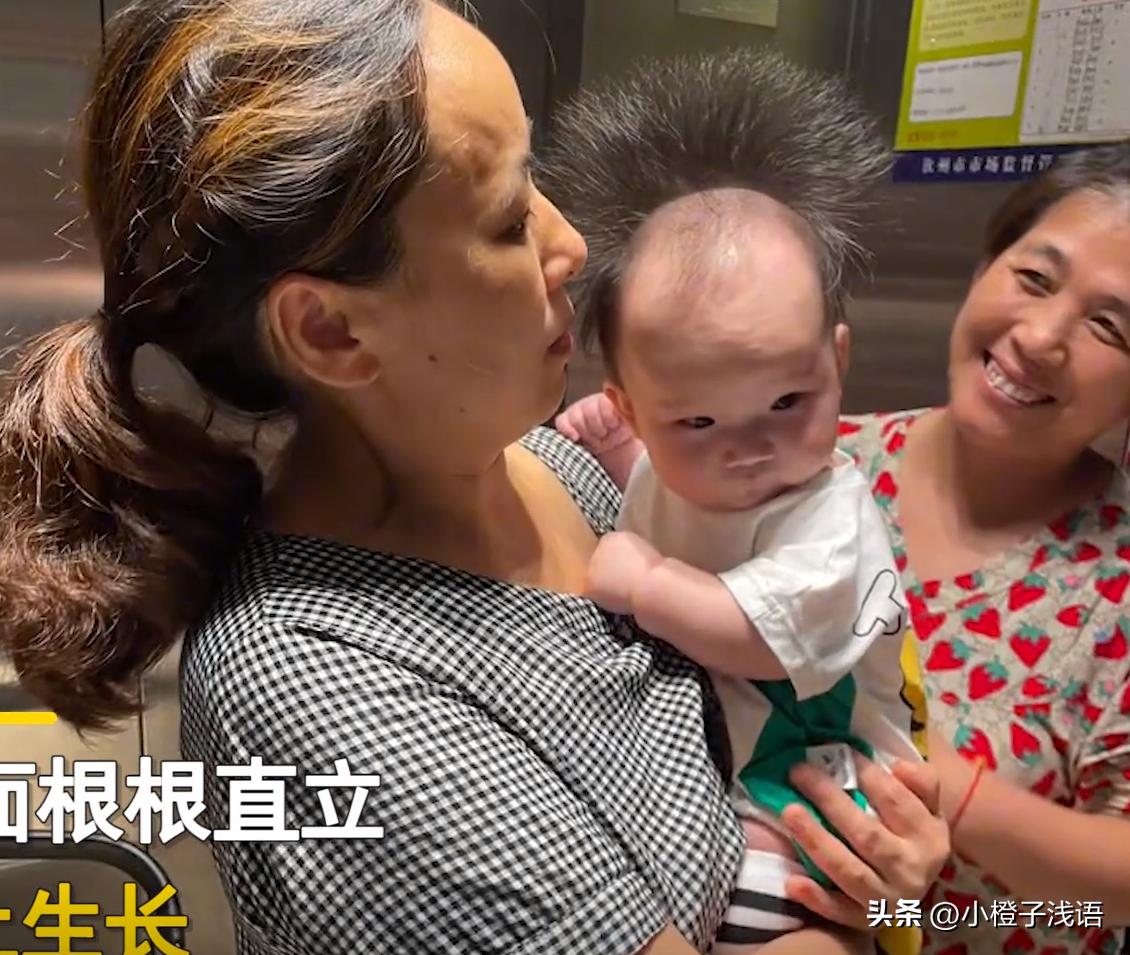 幼儿头发秃顶,幼儿前额秃顶