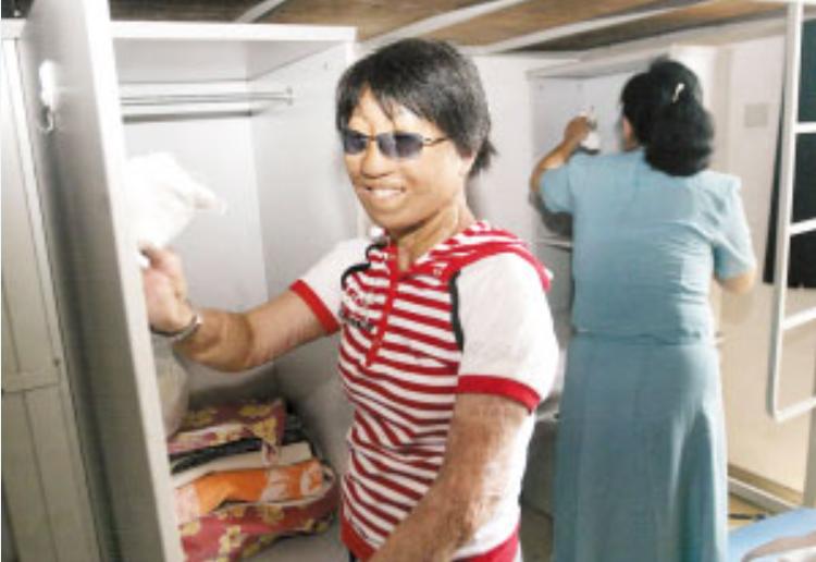 15岁妙龄少女被烧伤,19岁花季少女被烧伤后续