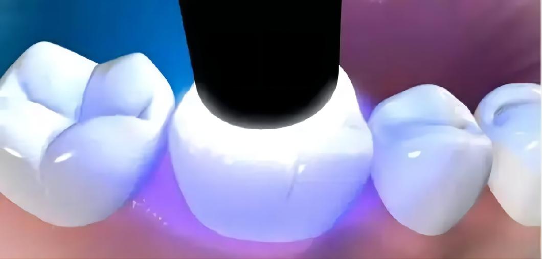 高分子胶多久能黏合,高分子胶水多久能黏合