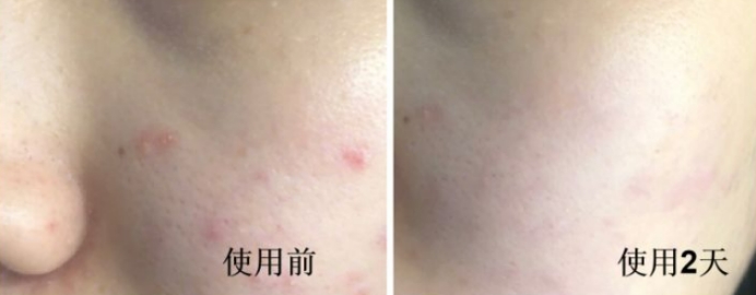 孕期适合的大牌水乳,孕期的平价水乳推荐测评