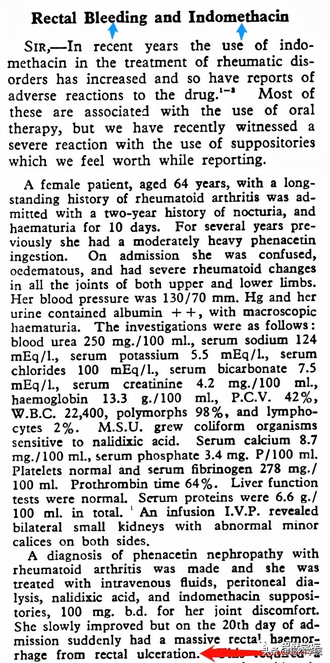 吲哚美辛栓能治内痔疮吗,吲哚美辛栓可以缓解痔疮疼痛吗