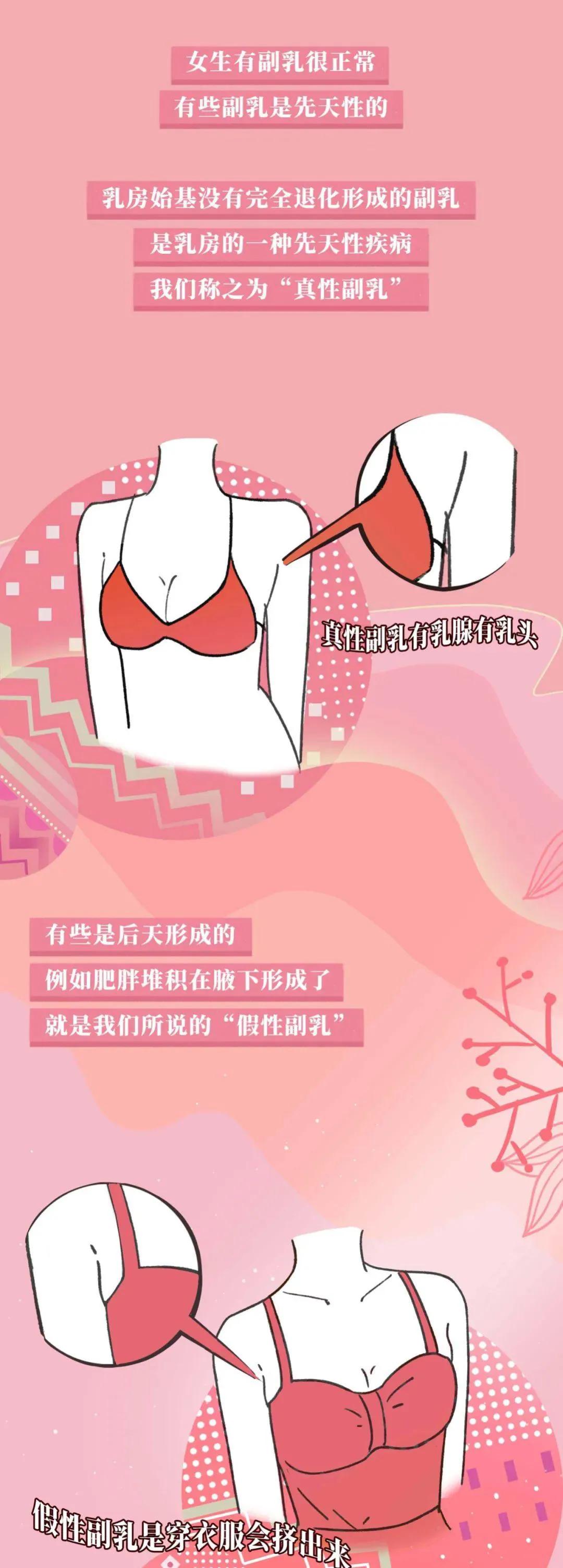 正常乳房有哪几种,乳房整形有哪几种类型