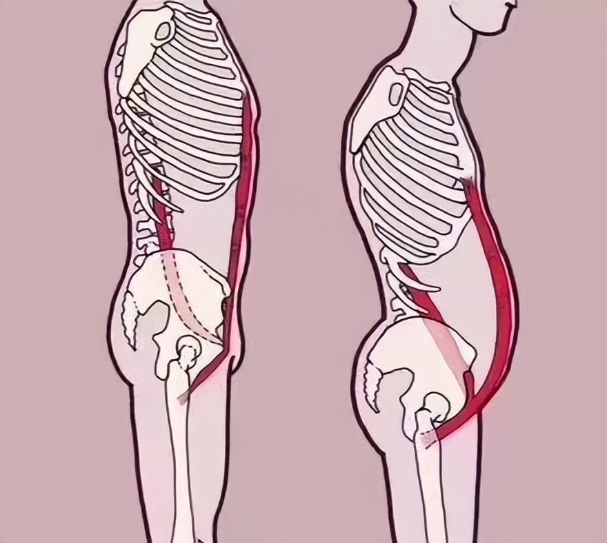 产后10个月漏尿怎么恢复,产后腰疼漏尿什么原因