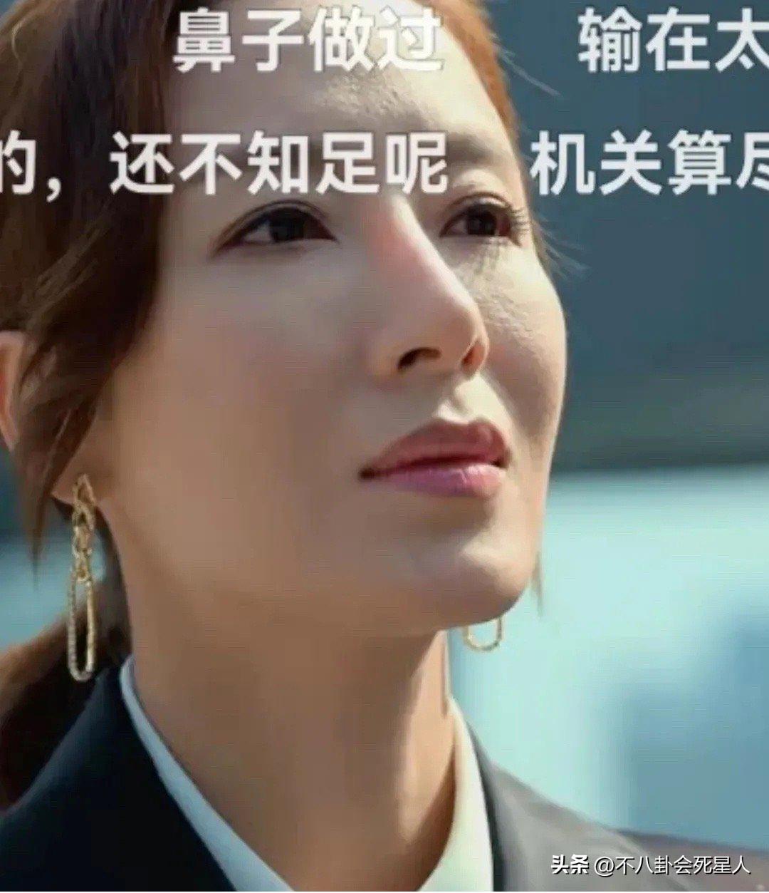 假双眼皮的明星,明星的假脸