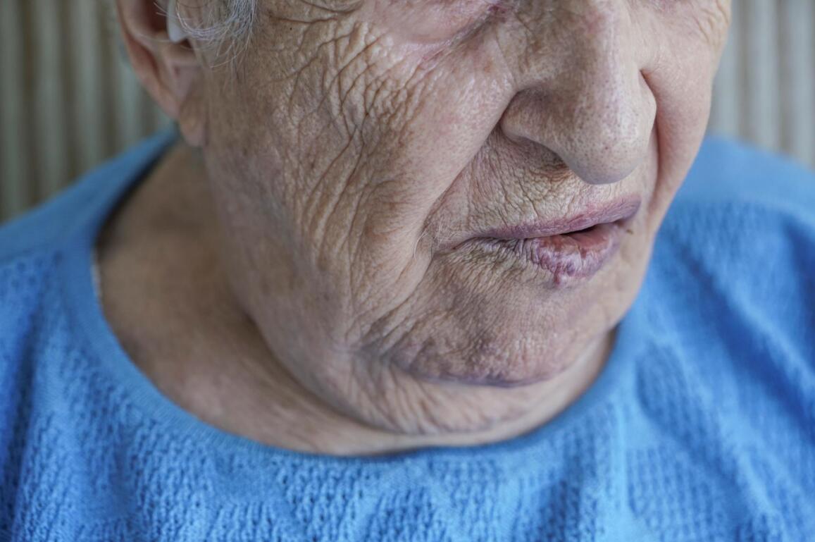 对高龄患者来说，得了肿瘤选手术还是保守治疗？医生给你参考意见