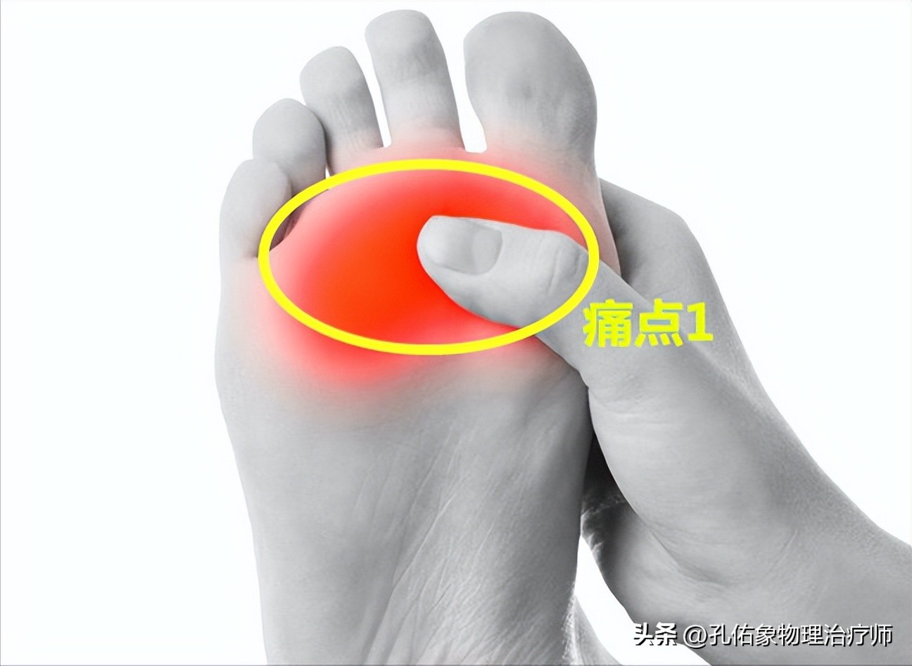 脚部信号透露健康问题,脚部出现这6种症状