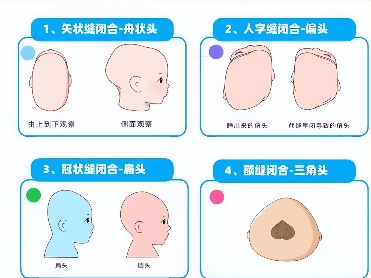 1岁半宝宝适合戴的发箍,1岁半的宝宝偏头还睡得过来吗