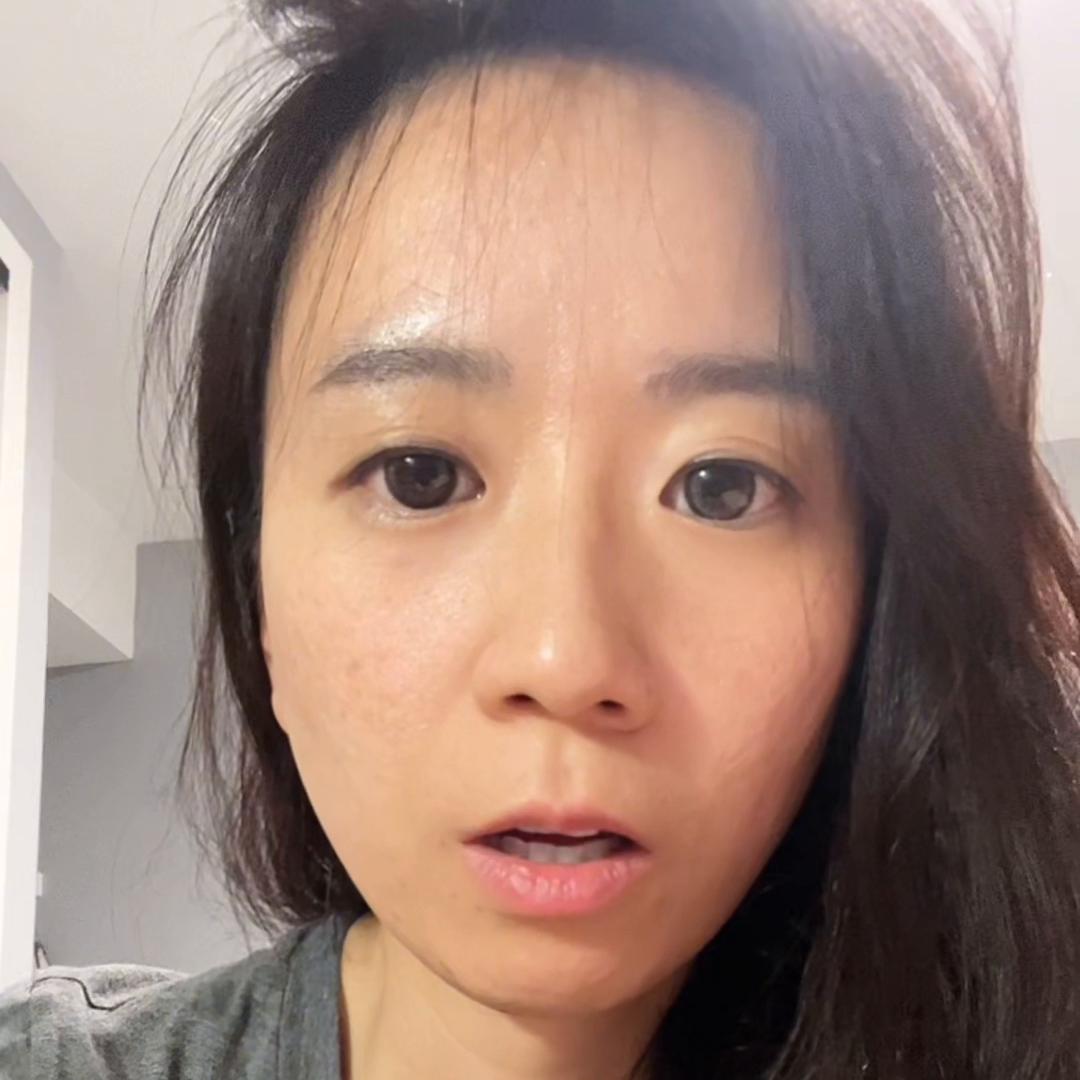 姐妹治好痘痘的视频,姐妹们广州治疗痘痘