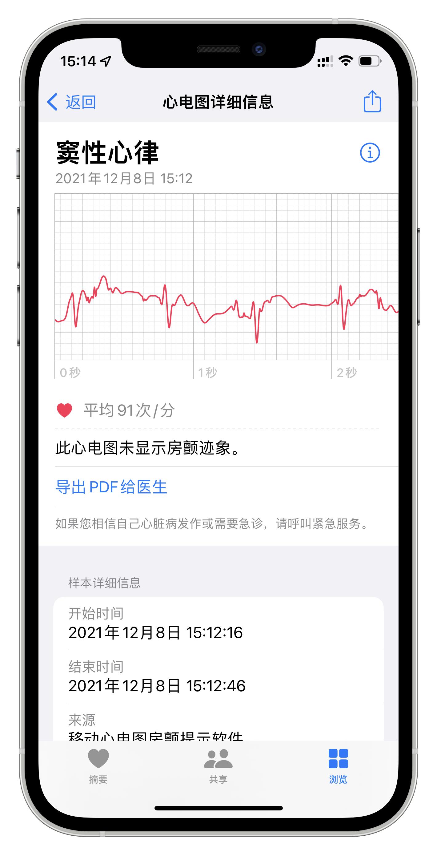 ios15.2的隐藏功能,ios15.2后的新功能