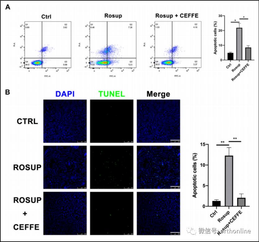 无细胞脂肪活性蛋白预防骨质疏松研究